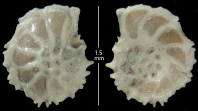 Foraminiferan, Epistomena spinulifera